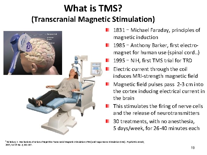 What is TMS? (Transcranial Magnetic Stimulation) 1831 – Michael Faraday, principles of magnetic induction