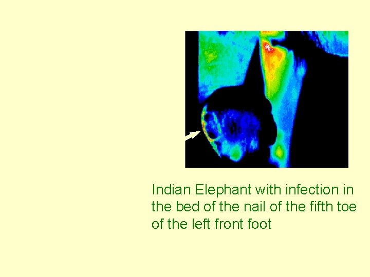 Indian Elephant with infection in the bed of the nail of the fifth toe