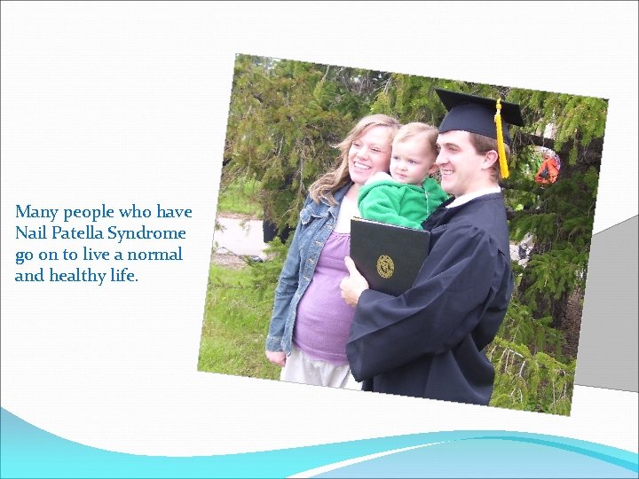 Many people who have Nail Patella Syndrome go on to live a normal and