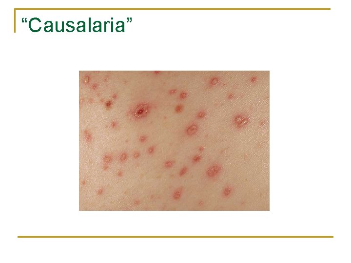 “Causalaria” 