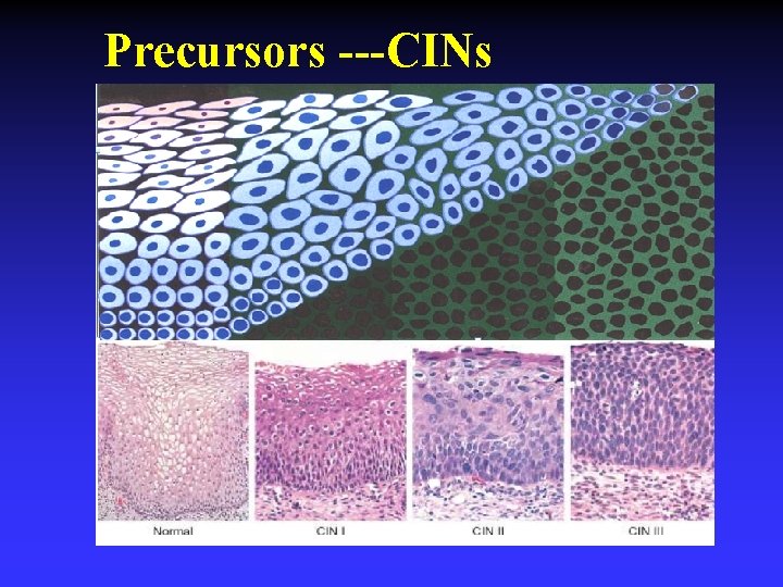Precursors ---CINs 