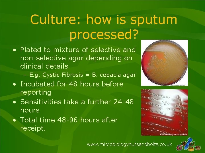 Culture: how is sputum processed? • Plated to mixture of selective and non-selective agar Culture: how is sputum processed? • Plated to mixture of selective and non-selective agar