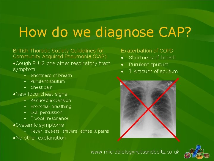 How do we diagnose CAP? British Thoracic Society Guidelines for Community Acquired Pneumonia (CAP) How do we diagnose CAP? British Thoracic Society Guidelines for Community Acquired Pneumonia (CAP)