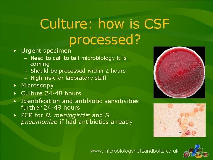 Culture: how is CSF processed? • Urgent specimen – Need to call to tell