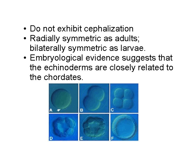 • Do not exhibit cephalization • Radially symmetric as adults; bilaterally symmetric as • Do not exhibit cephalization • Radially symmetric as adults; bilaterally symmetric as