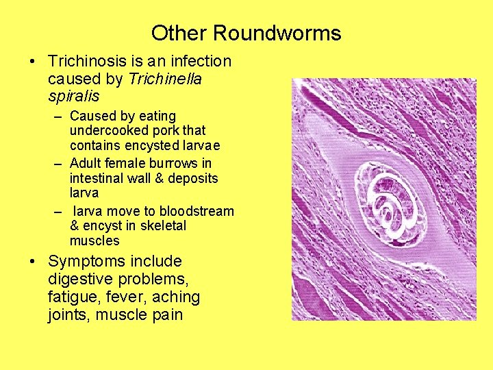 Other Roundworms • Trichinosis is an infection caused by Trichinella spiralis – Caused by