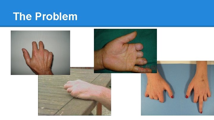 The Problem 