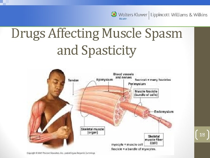 Drugs Affecting Muscle Spasm and Spasticity 18 Copyright © 2012 Wolters Kluwer Health |