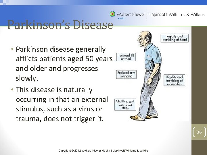 Parkinson’s Disease • Parkinson disease generally afflicts patients aged 50 years and older and