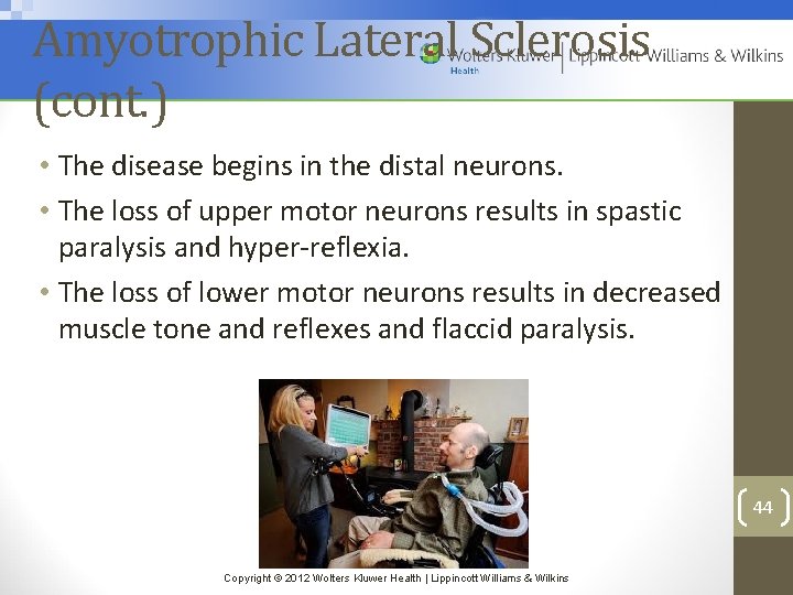 Amyotrophic Lateral Sclerosis (cont. ) • The disease begins in the distal neurons. •