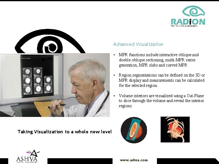 Advanced Visualization • MPR functions include interactive oblique and double-oblique sectioning, multi-MPR series generation,