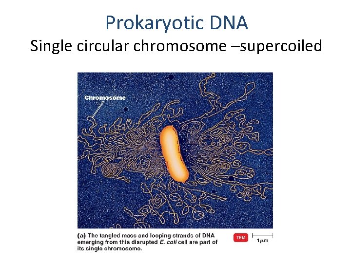 Prokaryotic DNA Single circular chromosome –supercoiled 