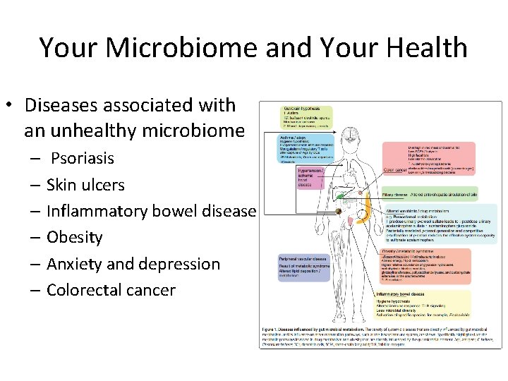 Your Microbiome and Your Health • Diseases associated with an unhealthy microbiome – Psoriasis