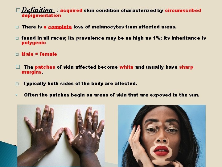 � Definition : acquired skin condition characterized by circumscribed depigmentation � There is a