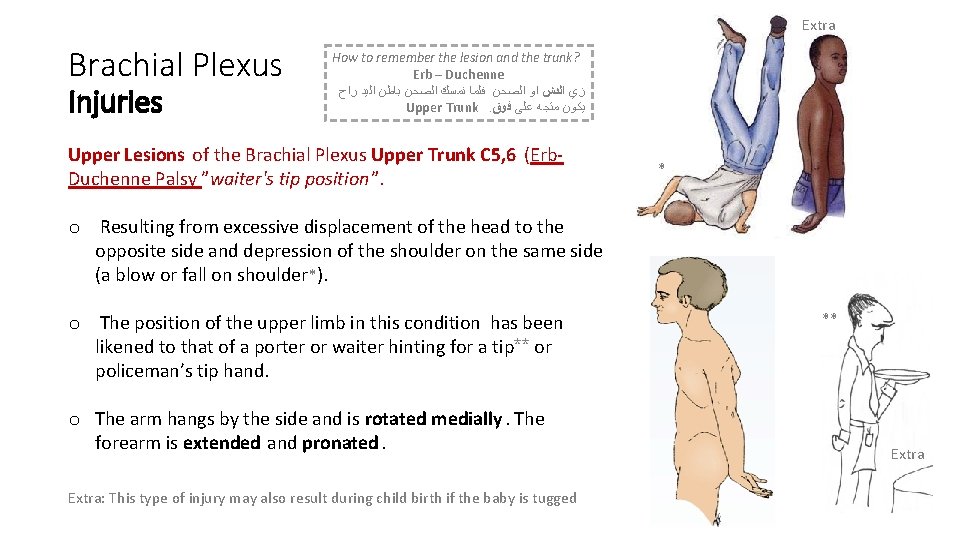 Extra Brachial Plexus Injuries How to remember the lesion and the trunk? Erb –