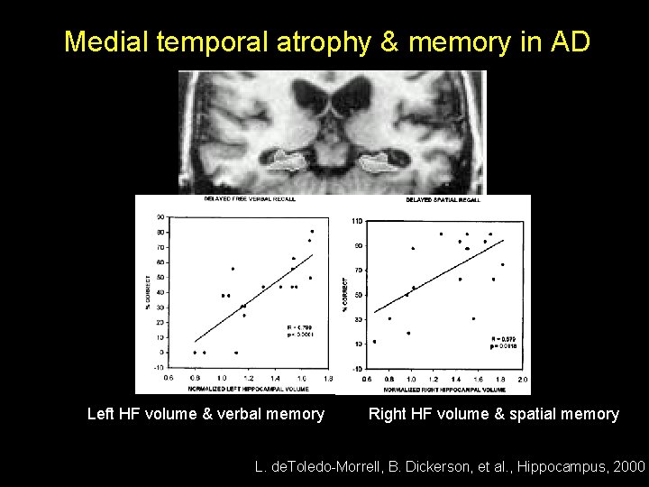 Medial temporal atrophy & memory in AD Left HF volume & verbal memory Right Medial temporal atrophy & memory in AD Left HF volume & verbal memory Right