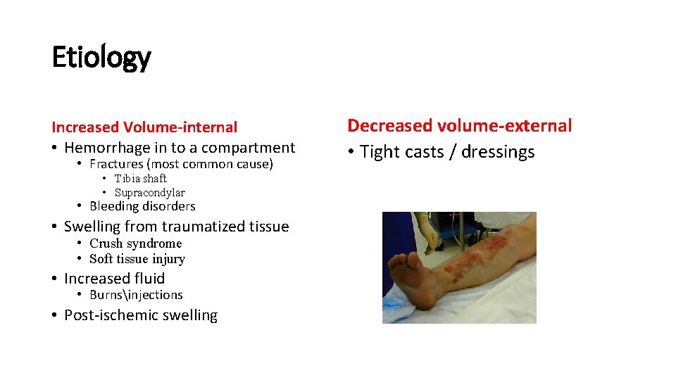 Etiology Increased Volume-internal • Hemorrhage in to a compartment • Fractures (most common cause)