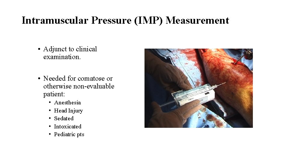 Intramuscular Pressure (IMP) Measurement • Adjunct to clinical examination. • Needed for comatose or