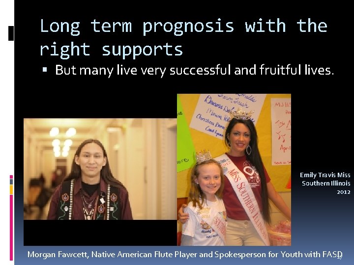 Long term prognosis with the right supports But many live very successful and fruitful