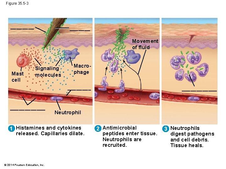 Figure 35. 5 -3 _______ Movement of fluid Mast cell Signaling molecules Macrophage ____________