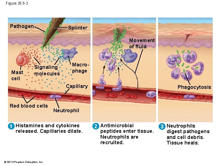 Figure 35. 5 -3 Pathogen Splinter Movement of fluid Mast cell Signaling molecules Macrophage