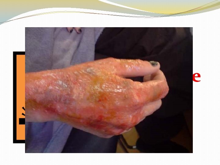 Laboratory Safety Symbols Corrosive 