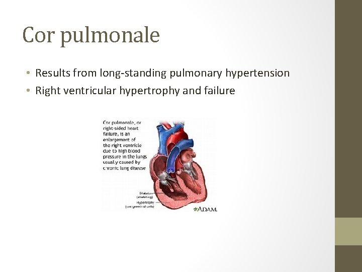 Cor pulmonale • Results from long-standing pulmonary hypertension • Right ventricular hypertrophy and failure