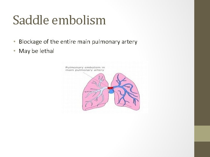 Saddle embolism • Blockage of the entire main pulmonary artery • May be lethal