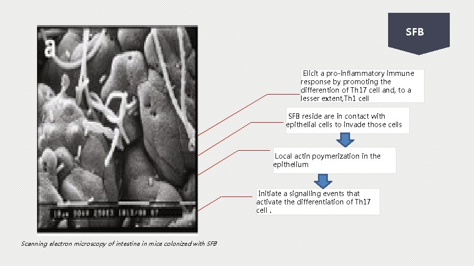 SFB Elicit a pro-inflammatory immune response by promoting the differention of Th 17 cell