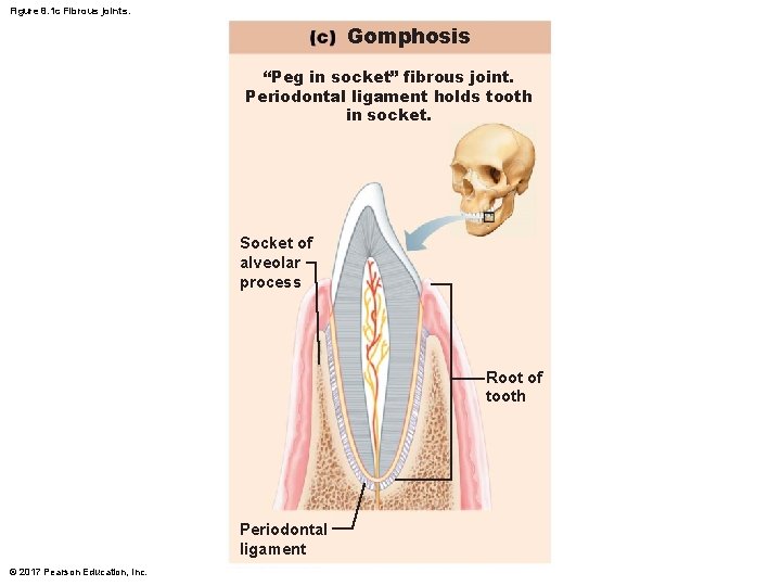 Figure 8. 1 c Fibrous joints. Gomphosis “Peg in socket” fibrous joint. Periodontal ligament