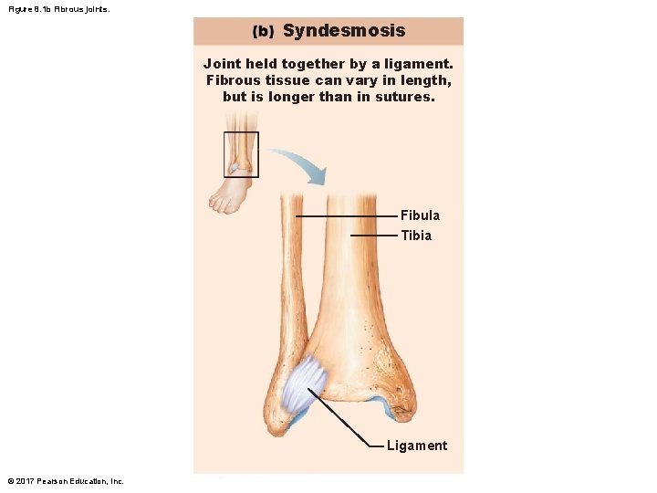 Figure 8. 1 b Fibrous joints. Syndesmosis Joint held together by a ligament. Fibrous