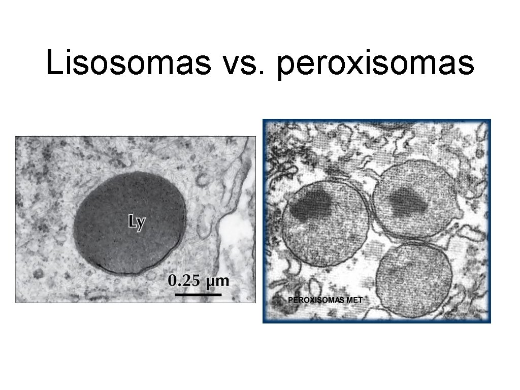 Lisosomas vs. peroxisomas 