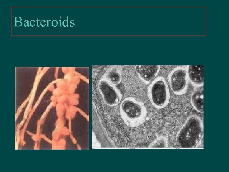 Bacteroids 