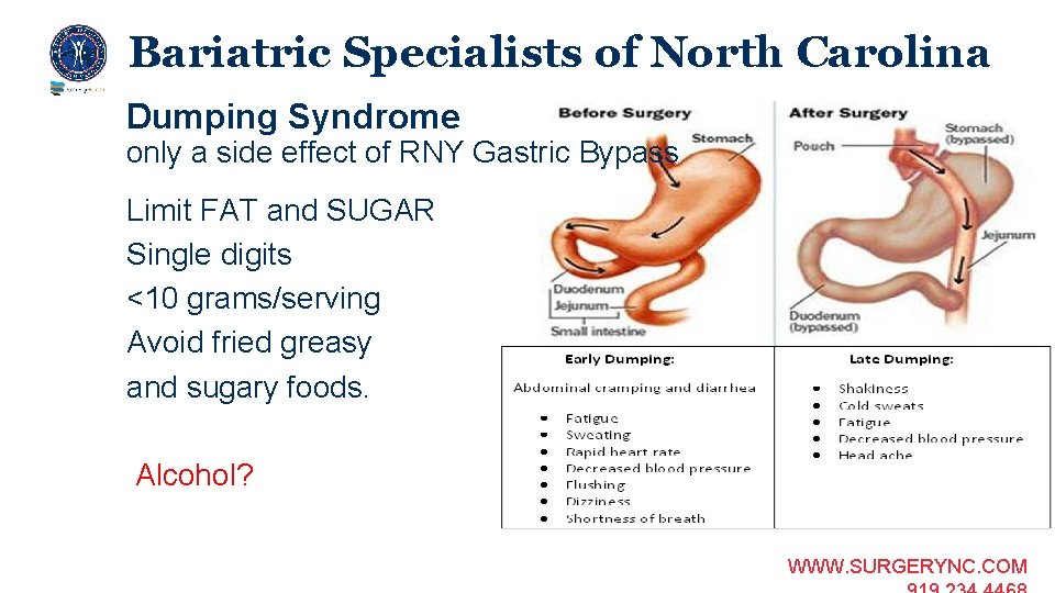 Bariatric Specialists of North Carolina Dumping Syndrome only a side effect of RNY Gastric