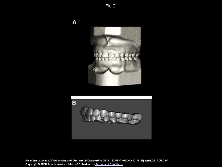 Fig 2 American Journal of Orthodontics and Dentofacial Orthopedics 2018 153741 -746 DOI: (10.