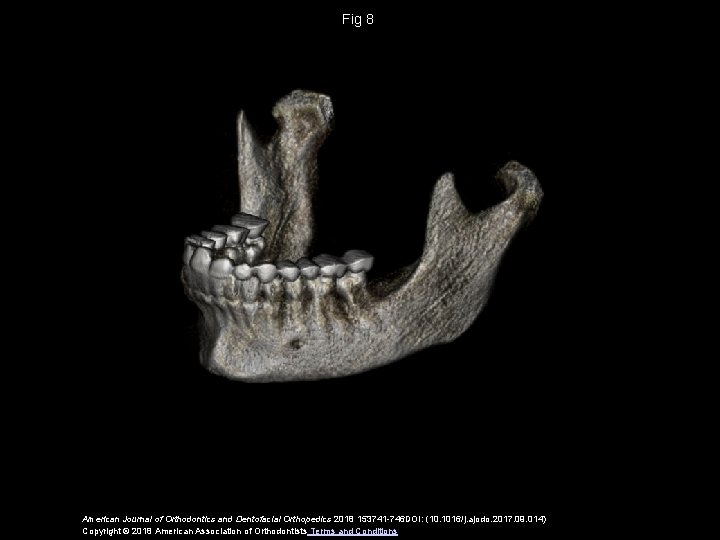 Fig 8 American Journal of Orthodontics and Dentofacial Orthopedics 2018 153741 -746 DOI: (10.