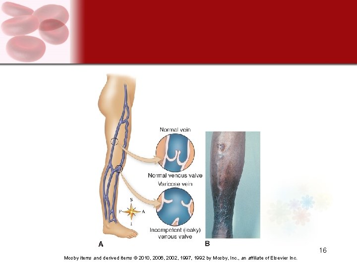 16 Mosby items and derived items © 2010, 2006, 2002, 1997, 1992 by Mosby,