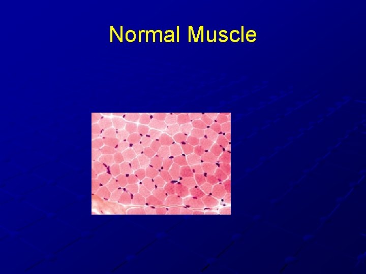 Normal Muscle Normal Muscle