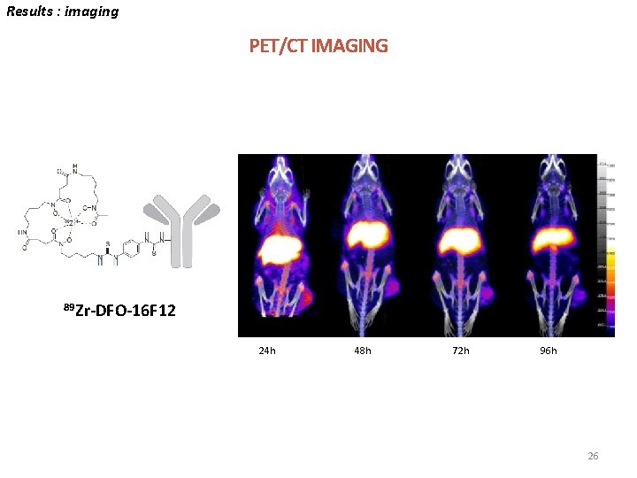 Results : imaging PET/CT IMAGING 89 Zr-DFO-16 F 12 24 h 48 h 72