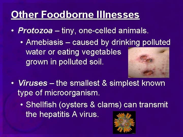 Other Foodborne Illnesses • Protozoa – tiny, one-celled animals. • Amebiasis – caused by