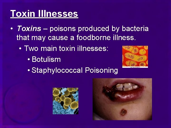 Toxin Illnesses • Toxins – poisons produced by bacteria that may cause a foodborne