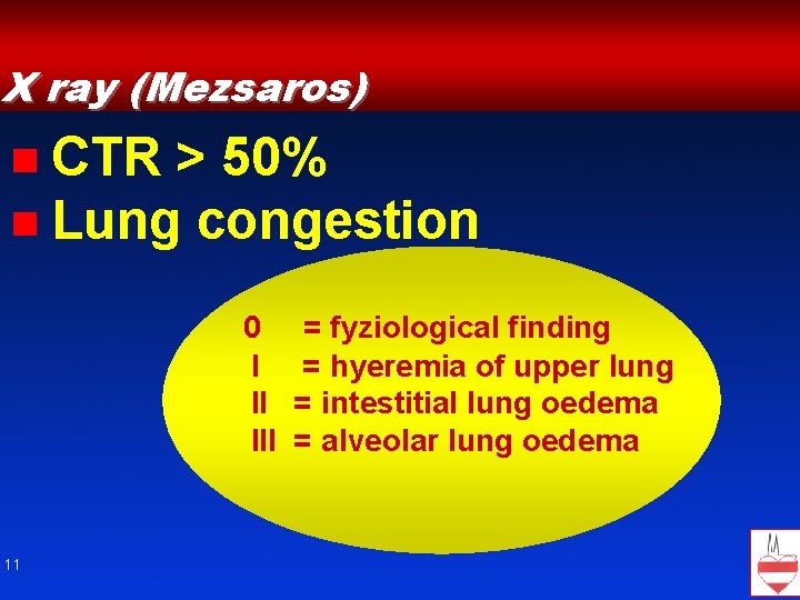 X ray (Mezsaros) n CTR > 50% n Lung congestion 0 I II III