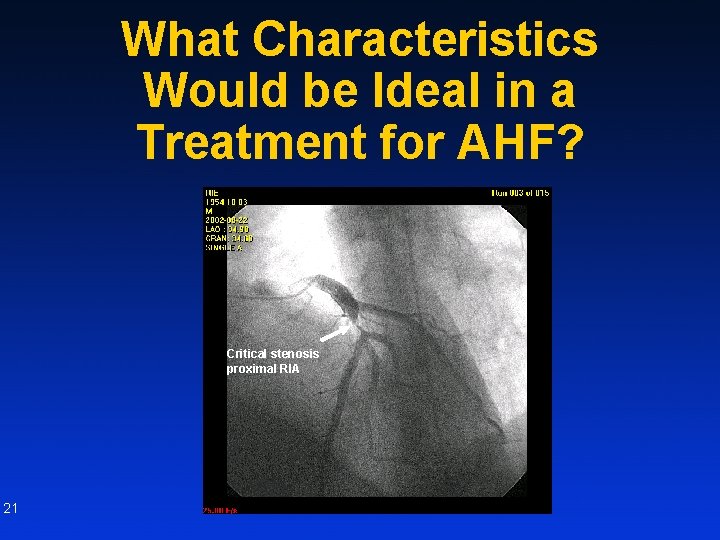 What Characteristics Would be Ideal in a Treatment for AHF? Critical stenosis proximal RIA