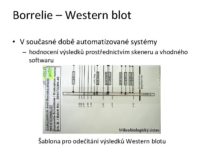 Borrelie – Western blot • V současné době automatizované systémy – hodnocení výsledků prostřednictvím