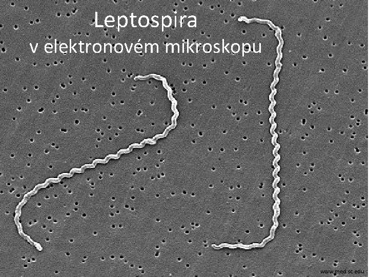 Leptospira v elektronovém mikroskopu www. med. sc. edu 