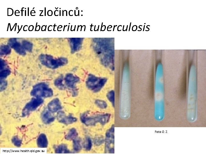 Defilé zločinců: Mycobacterium tuberculosis Foto O. Z. http: //www. health. qld. gov. au 