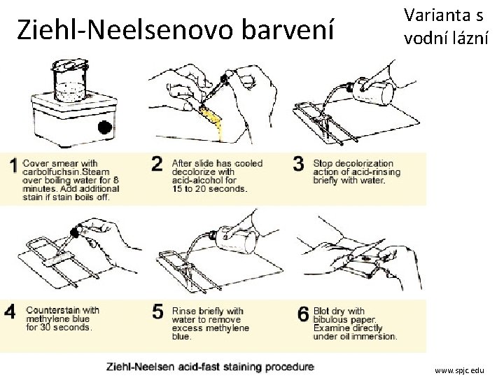 Ziehl-Neelsenovo barvení Varianta s vodní lázní www. spjc. edu 