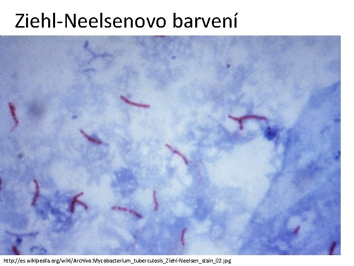 Ziehl-Neelsenovo barvení http: //es. wikipedia. org/wiki/Archivo: Mycobacterium_tuberculosis_Ziehl-Neelsen_stain_02. jpg 