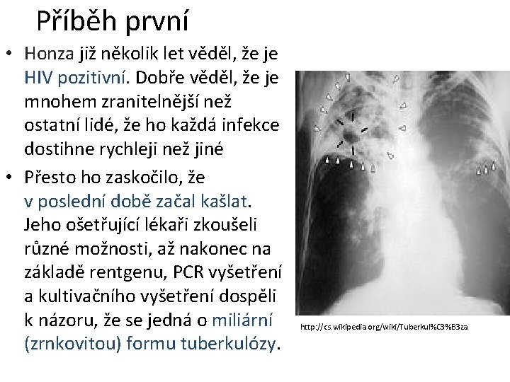 Příběh první • Honza již několik let věděl, že je HIV pozitivní. Dobře věděl,