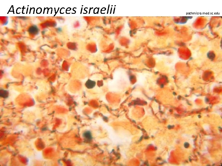 Actinomyces israelii pathmicro. med. sc. edu 
